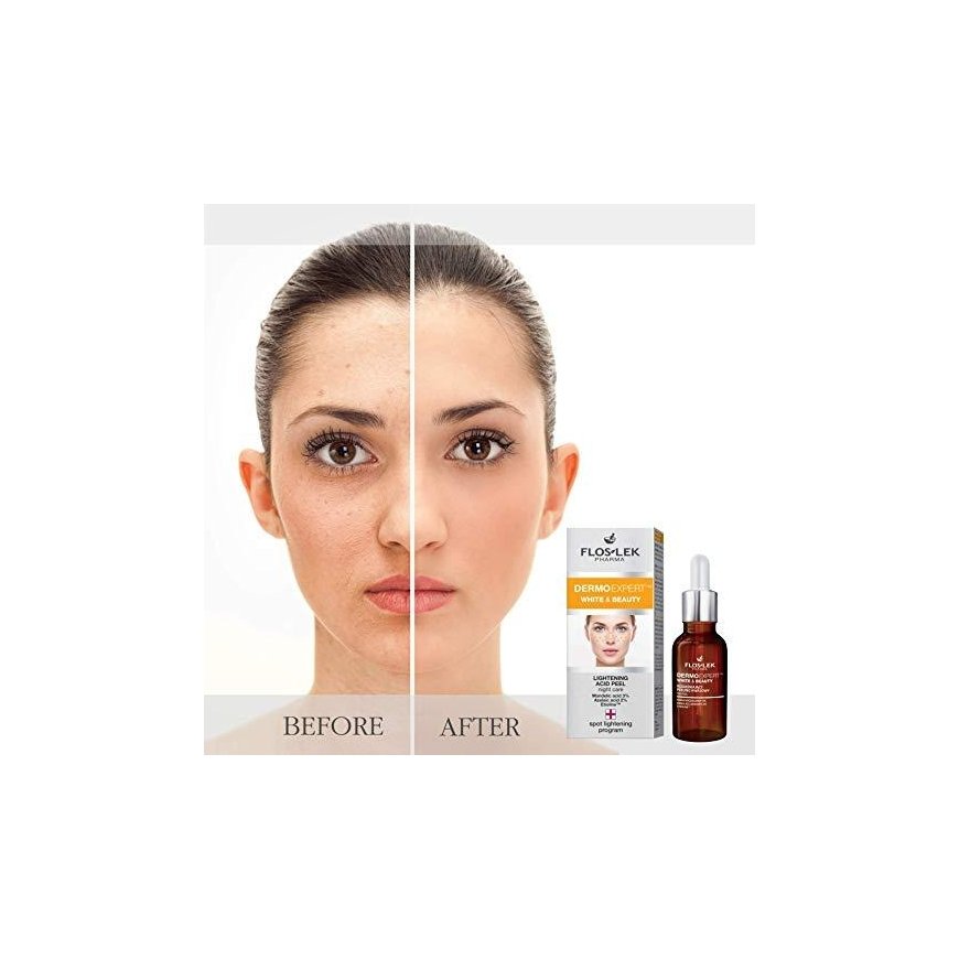FLOSLEK face scrub Pharma Dermo Expert White & Beauty lightening 30 ml – 3