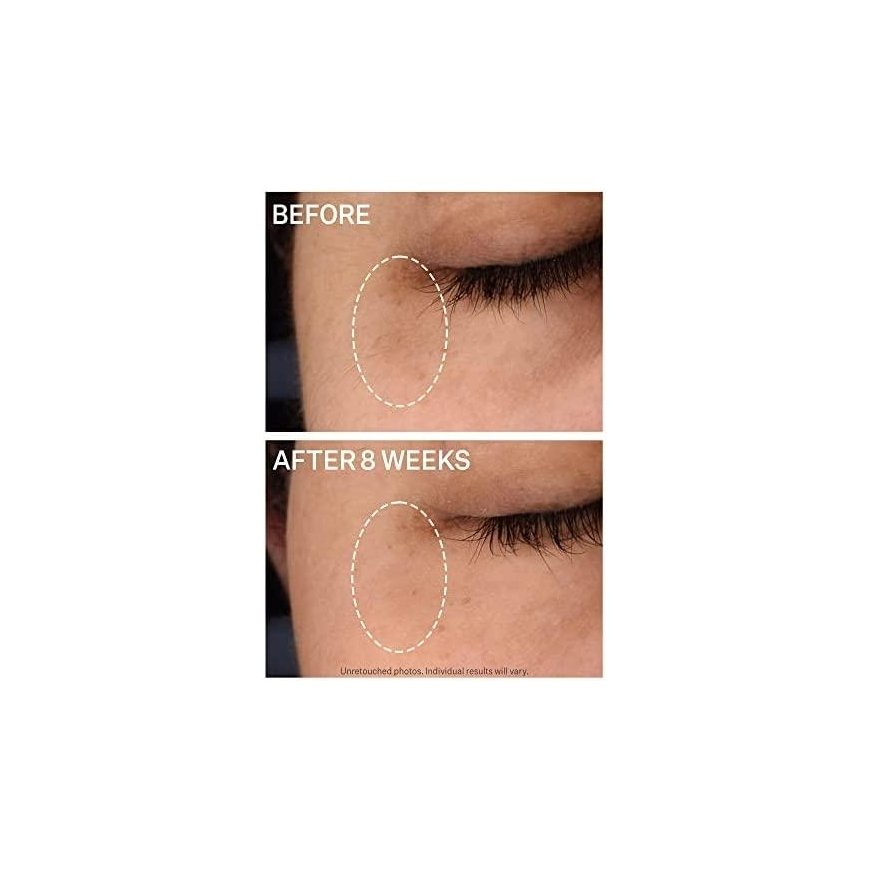 Strivectin Multi-Action Super-C Dark Circle Brightening Eye serumas 15ml – 5