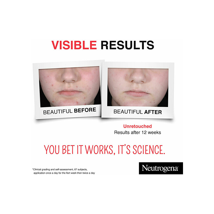 Neutrogena Clear & Defend+ Daily Serum Skin Serum unisex, 30 ml – 3
